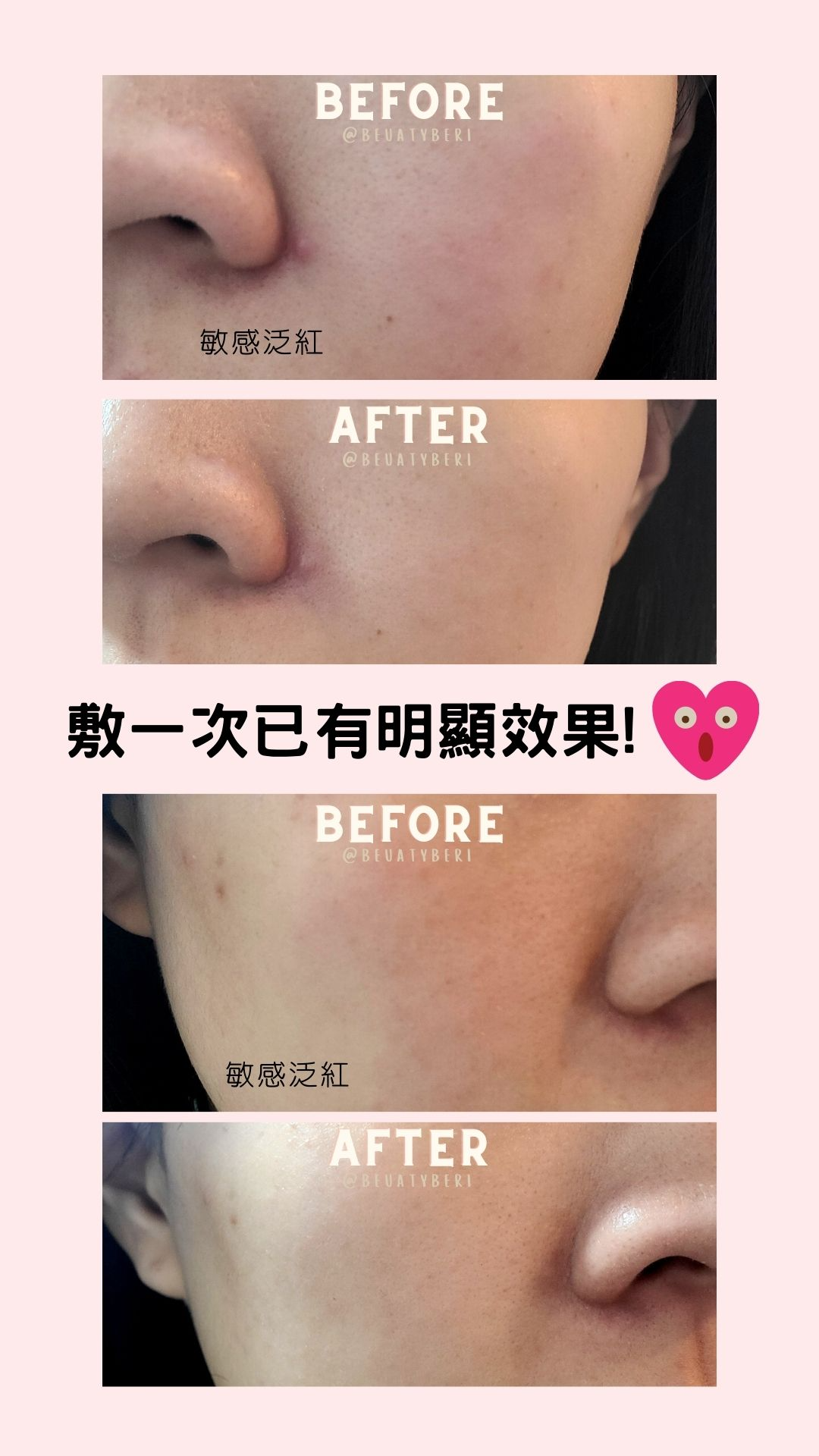 Pharmadex mask 退紅神奇面膜 - 15分鐘見效